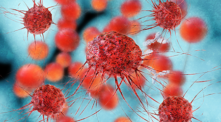 BC researchers uncover the tricks ovarian cancers use to escape the immune system